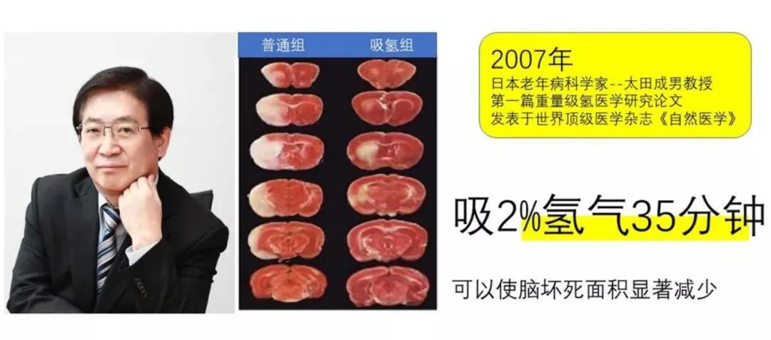 耐糖量损伤是糖尿病吗_耐糖量损伤_糖耐量受损亚健康