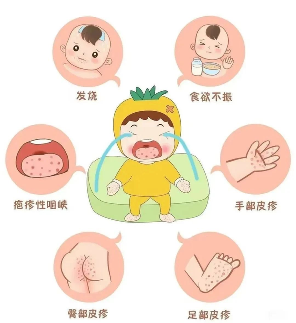 水痘可以健身吗_运动对水痘有好处吗_水痘健身